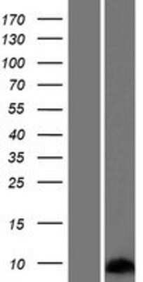 Western Blot: SPRR2G Overexpression Lysate [NBP2-08735]