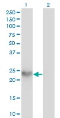 Western Blot: SPRR3 Antibody (4A12) [H00006707-M01]