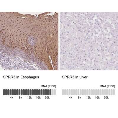 Immunohistochemistry-Paraffin: SPRR3 Antibody [NBP2-13374]