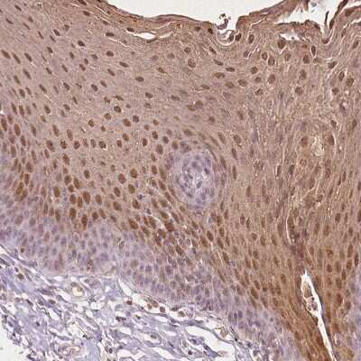 Immunohistochemistry-Paraffin: SPRR3 Antibody [NBP2-13374]