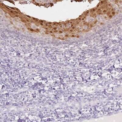 Immunohistochemistry-Paraffin: SPRR3 Antibody [NBP2-13374]