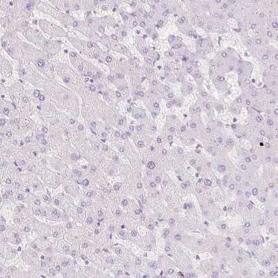 Immunohistochemistry-Paraffin: SPRR3 Antibody [NBP2-13374]