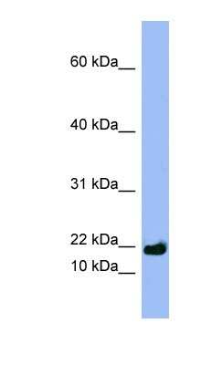 Western Blot: SPRR3 Antibody [NBP1-57647]