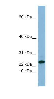 Western Blot: SPRR3 Antibody [NBP1-57679]