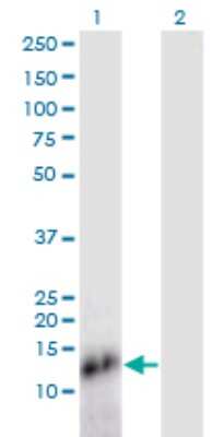 Western Blot: SPRR4 Antibody (1G5) [H00163778-M04]