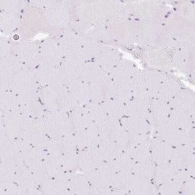 Immunohistochemistry-Paraffin: SPRR4 Antibody [NBP2-30889]