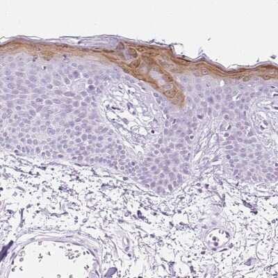 Immunohistochemistry-Paraffin: SPRR4 Antibody [NBP2-30889]