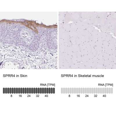 Immunohistochemistry-Paraffin: SPRR4 Antibody [NBP2-30889]