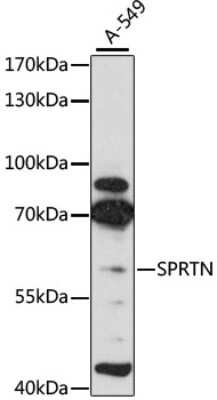 Western Blot: SPRTN AntibodyAzide and BSA Free [NBP2-93630]