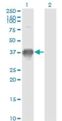 Western Blot: SPRY1 Antibody (2F1) [H00010252-M02]