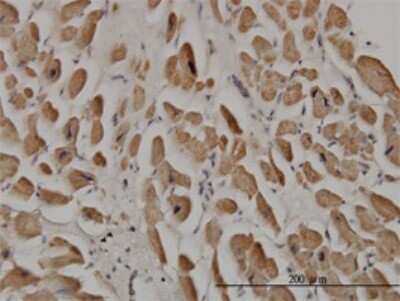 Immunohistochemistry-Paraffin: SPRY1 Antibody (3H4) [H00010252-M01]