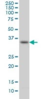 Western Blot: SPRY1 Antibody (3H4) [H00010252-M01]