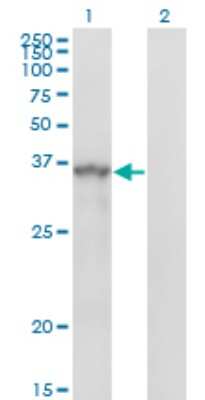 Western Blot: SPRY1 Antibody (3H4) [H00010252-M01]