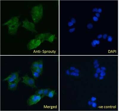 Immunocytochemistry/ Immunofluorescence: SPRY1 Antibody [NBP1-51918]