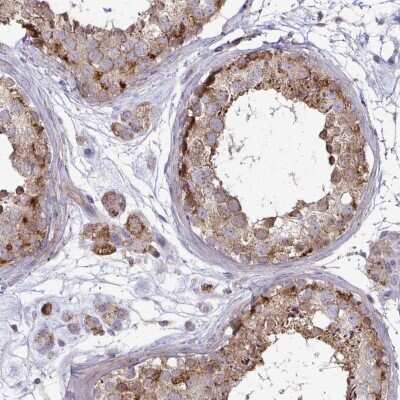 Immunohistochemistry-Paraffin: SPRY1 Antibody [NBP2-37929]