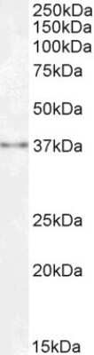 Western Blot: SPRY1 Antibody [NBP1-51918]