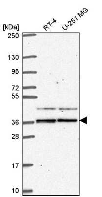 Western Blot: SPRY1 Antibody [NBP2-57267]