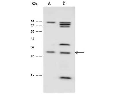 Western Blot: SPRY1 Antibody [NBP2-99516]