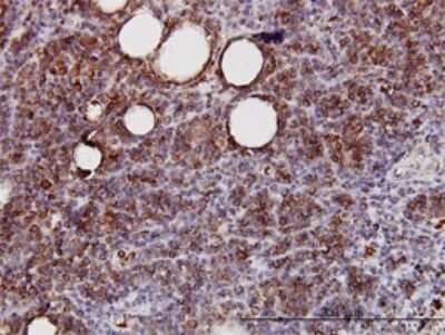 Immunohistochemistry-Paraffin: SPRY2 Antibody (1E10) [H00010253-M01]