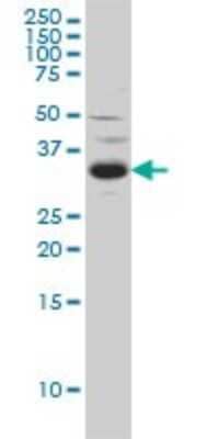 Western Blot: SPRY2 Antibody (1E10) [H00010253-M01]