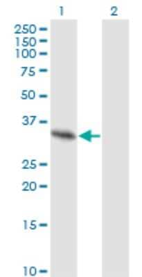 Western Blot: SPRY2 Antibody (1E10) [H00010253-M01]