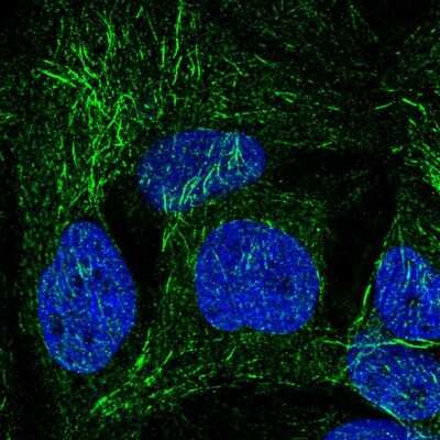 Immunocytochemistry/ Immunofluorescence: SPRY2 Antibody [NBP2-59001]