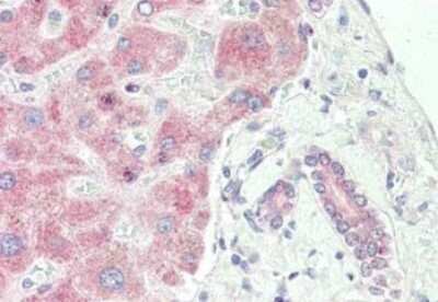 Immunohistochemistry: SPRY2 Antibody [NBP2-13158]