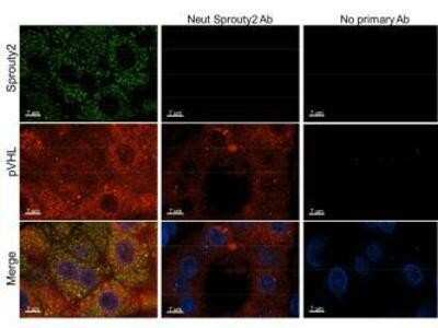 Immunohistochemistry-Paraffin: SPRY2 Antibody [NBP2-13158]