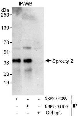 Immunoprecipitation: SPRY2 Antibody [NBP2-04099]