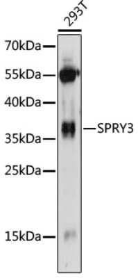 Western Blot: SPRY3 AntibodyAzide and BSA Free [NBP2-93748]