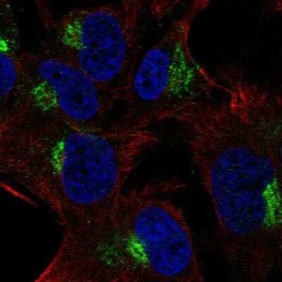 Immunocytochemistry/ Immunofluorescence: SPRY4 Antibody [NBP2-68941]