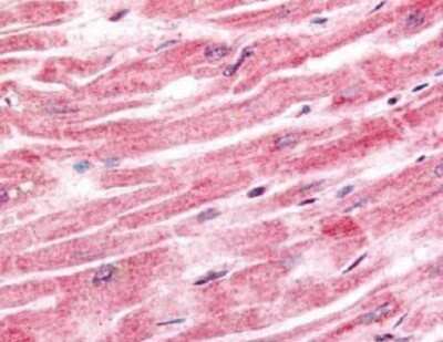 Immunohistochemistry-Paraffin: SPRY4 Antibody [NB100-2032]