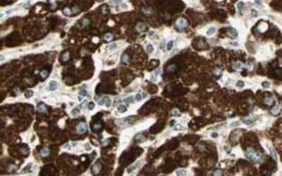Immunohistochemistry-Paraffin: SPRY4 Antibody [NB100-2032]