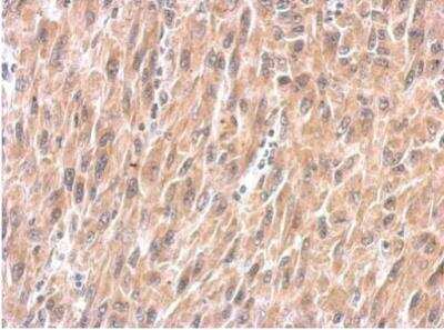 Immunohistochemistry-Paraffin: SPRY4 Antibody [NBP2-20479]