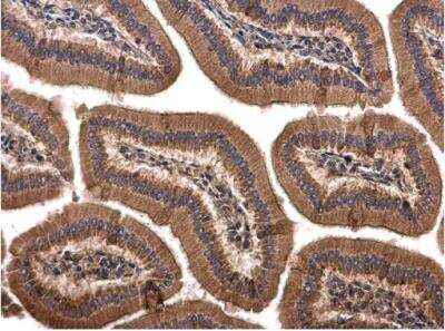 Immunohistochemistry-Paraffin: SPRY4 Antibody [NBP2-20479]