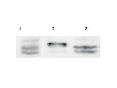 Western Blot: SPRY4 Antibody [NB100-2032]