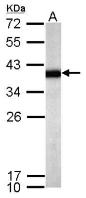 Western Blot: SPRY4 Antibody [NBP2-20479]