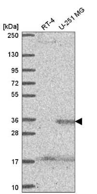 Western Blot: SPRY4 Antibody [NBP2-56160]