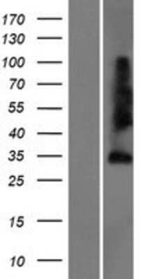 Western Blot: SPRY4 Overexpression Lysate [NBP2-06152]