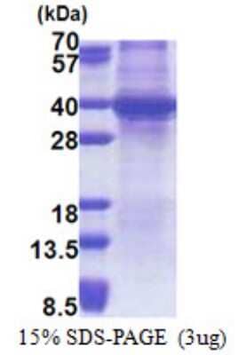 SDS-PAGE: Recombinant Human SPRY4 His Protein [NBP2-22822]