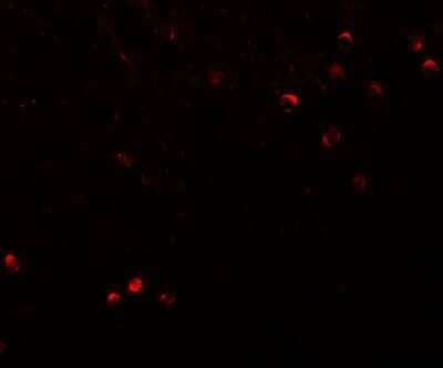 Immunohistochemistry: SPRYD3 Antibody - BSA Free [NBP1-77116]