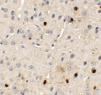 Immunohistochemistry: SPRYD3 Antibody - BSA Free [NBP1-77116]