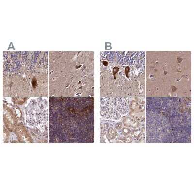Immunohistochemistry-Paraffin: SPRYD3 Antibody [NBP1-83681]