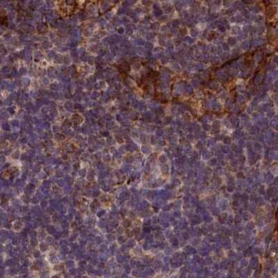 Immunohistochemistry-Paraffin: SPRYD3 Antibody [NBP1-83681]