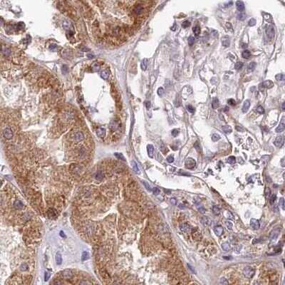 Immunohistochemistry-Paraffin: SPRYD3 Antibody [NBP1-83681]