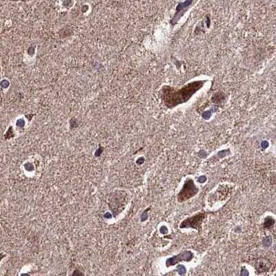 Immunohistochemistry-Paraffin: SPRYD3 Antibody [NBP1-83681]