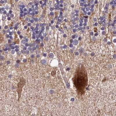 Immunohistochemistry-Paraffin: SPRYD3 Antibody [NBP1-83681]
