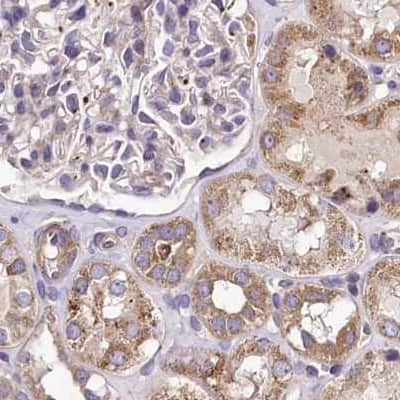 Immunohistochemistry-Paraffin: SPRYD3 Antibody [NBP2-38451]