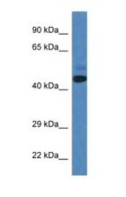 Western Blot: SPRYD3 Antibody [NBP1-74270]