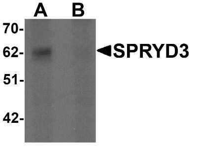 Western Blot: SPRYD3 AntibodyBSA Free [NBP1-77116]